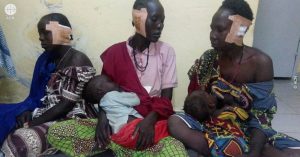 Boko Haram strikes back in Cameroon - Amputee women, the new tactic of terror